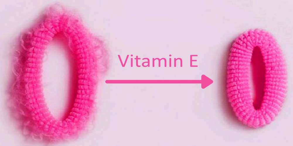 سفت کردن واژن با ویتامین E