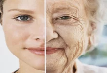 دلایل پیری زودرس پوست و راه های پیشگیری