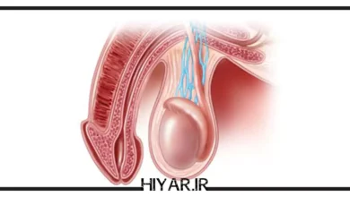 علت و دلیل درد بیضه چیست؟