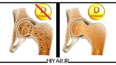 کمبود ویتامین D، مشکلی فراتر از استخوان‌ها