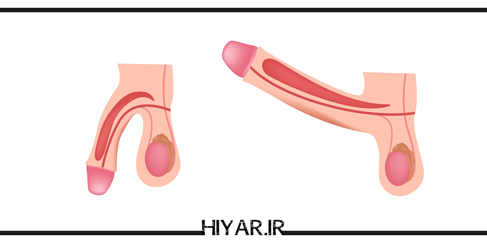 رابطه جنسی و سرطان پروستات، حفظ زندگی جنسی خود در هنگام افزایش سن